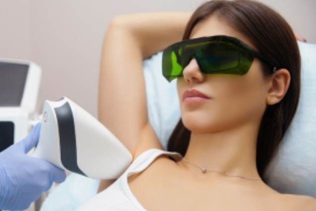 Αποτρίχωση με laser